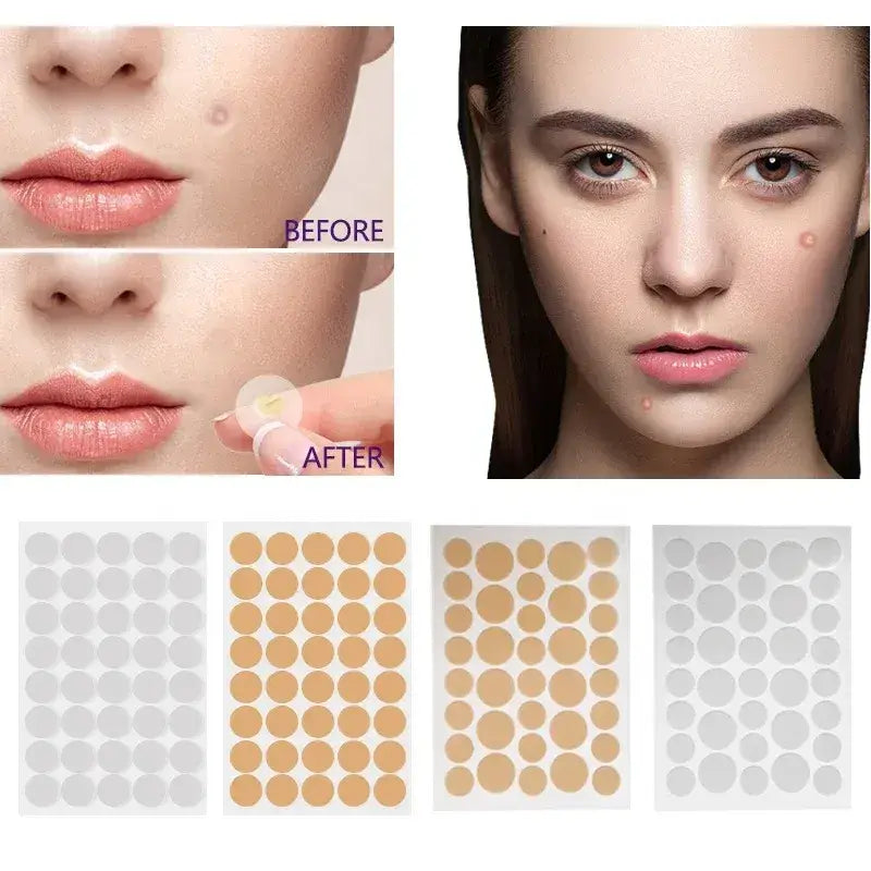 24 Parches Para Eliminar El Acné